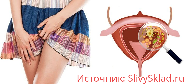Картинка [Валентина Скороход] Молочница. Цистит (2020)
