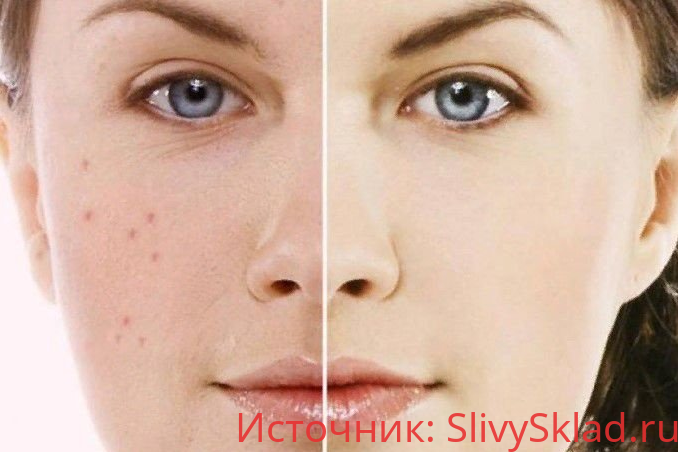 Картинка [Наталия Ткаченко] Жирная кожа (2019)