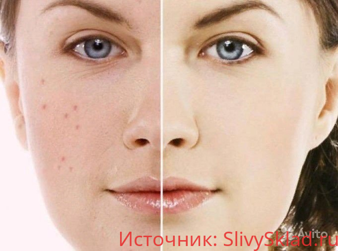 Картинка [Наталия Ткаченко] Жирная кожа (2019)