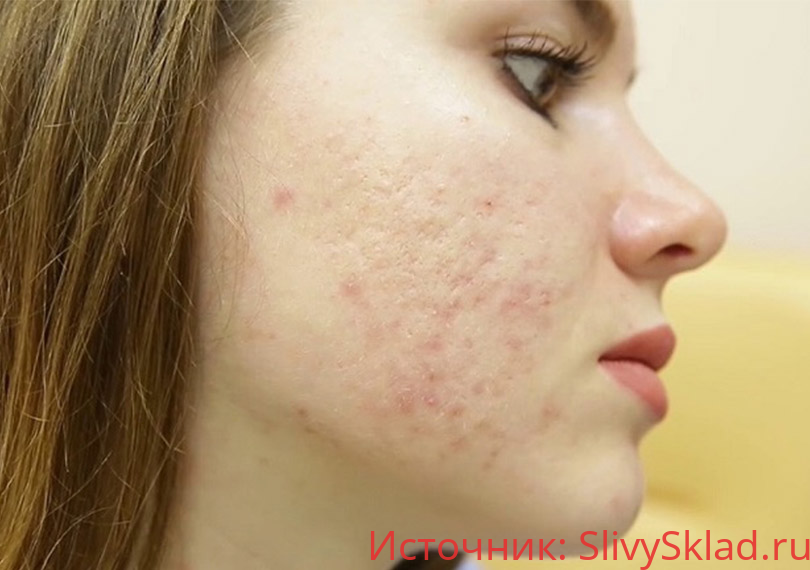 Картинка [linabeauty_official] ГАЙД ПОСТАКНЕ